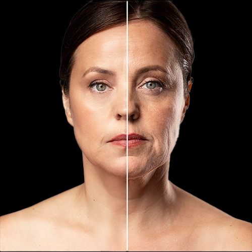 Side-by-side comparison of a woman before and after anti-wrinkle treatment showing smoother and younger-looking skin