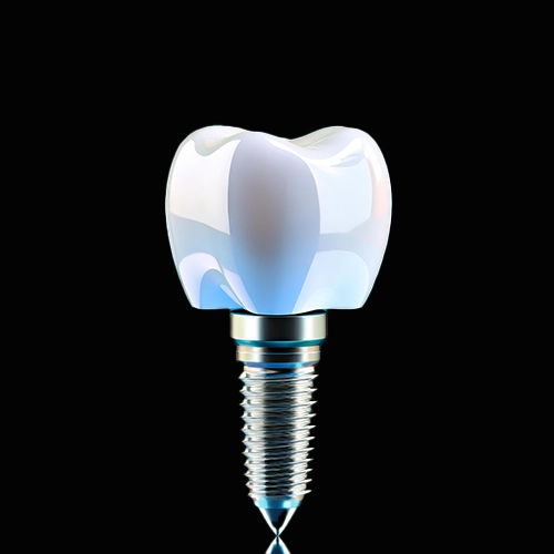 Illustration of a dental implant with a crown used to replace a missing tooth and restore function.