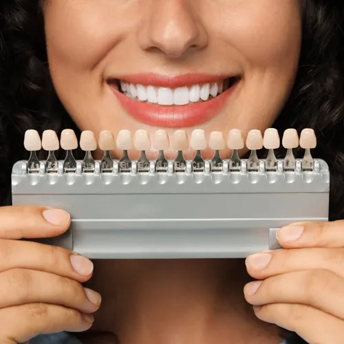 Woman smiling while holding a dental shade guide to match tooth color for veneers or whitening treatment