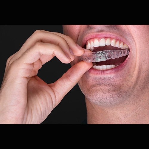 Young man with healthy smile representing TMJ splint use for jaw alignment and teeth protection