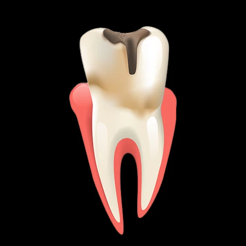 Advanced microscopic dentistry being used for a detailed root canal procedure to ensure maximum accuracy and patient safety.
